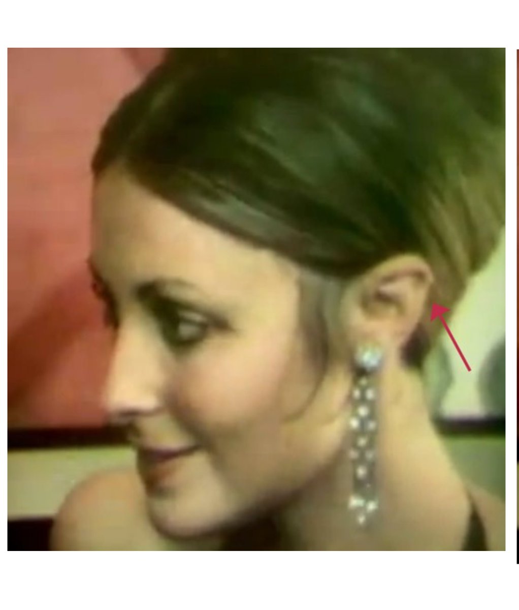 15 of 25Here are photos of Sharon Tate’s ear, which we just caught “Pati” wearing during the 25th anniversary interview.Pati is SHARON! We are told 6 years after this interview “Pati” dies of cancer. Did someone catch-on via the ear slip sending “Pati” (Sharon) into hiding?