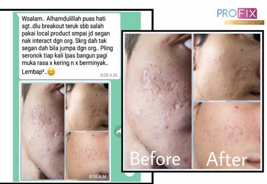 profix_vitamin's tweet photo. Pagi2 dah dapat surprise dari customer 🥰 https://t.co/98kBcG4G22