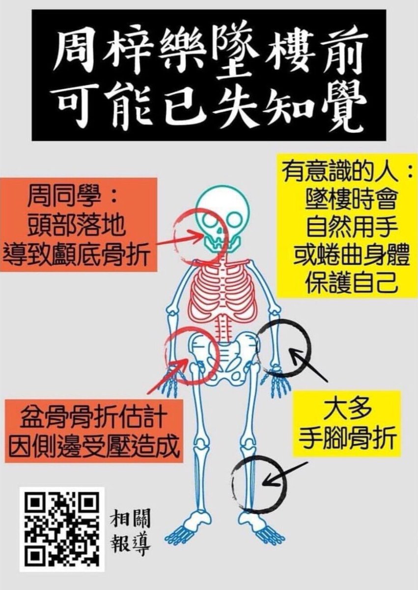 tkysnx's tweet photo. Last Friday, student Chow Tze-lok died from injuries. HK police claimed it to be a suicide and that he fell from 2/F to the car park below. However, the autopsy revealed it to be a lie.

我整嘅英文翻譯版本，請廣傳。🙏🏻

#HongKongProstest
#Suicide
#手足互科 https://t.co/XGZsnqpShZ