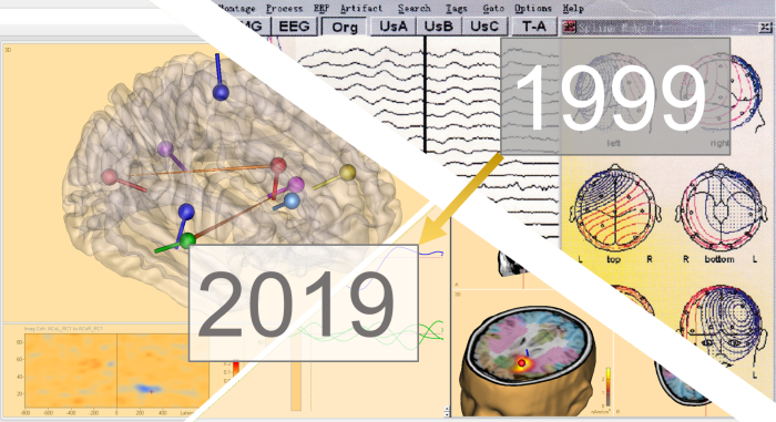 BesaGmbh's tweet image. Marking twenty years of BESA 99! 
BESA is a pioneer of #sourcelocalization in #EEG and #MEG data analysis, combining this with intuitive review features. 
Check out the full story on besa.de/allgemein/mark…