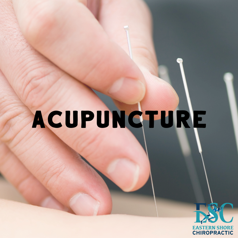 ESchiropractic's tweet photo. Interested in acupuncture? Give us a call at (251) 990-8383 for more information! #ESChiro #Acupuncture https://t.co/bd1uAC4dbm