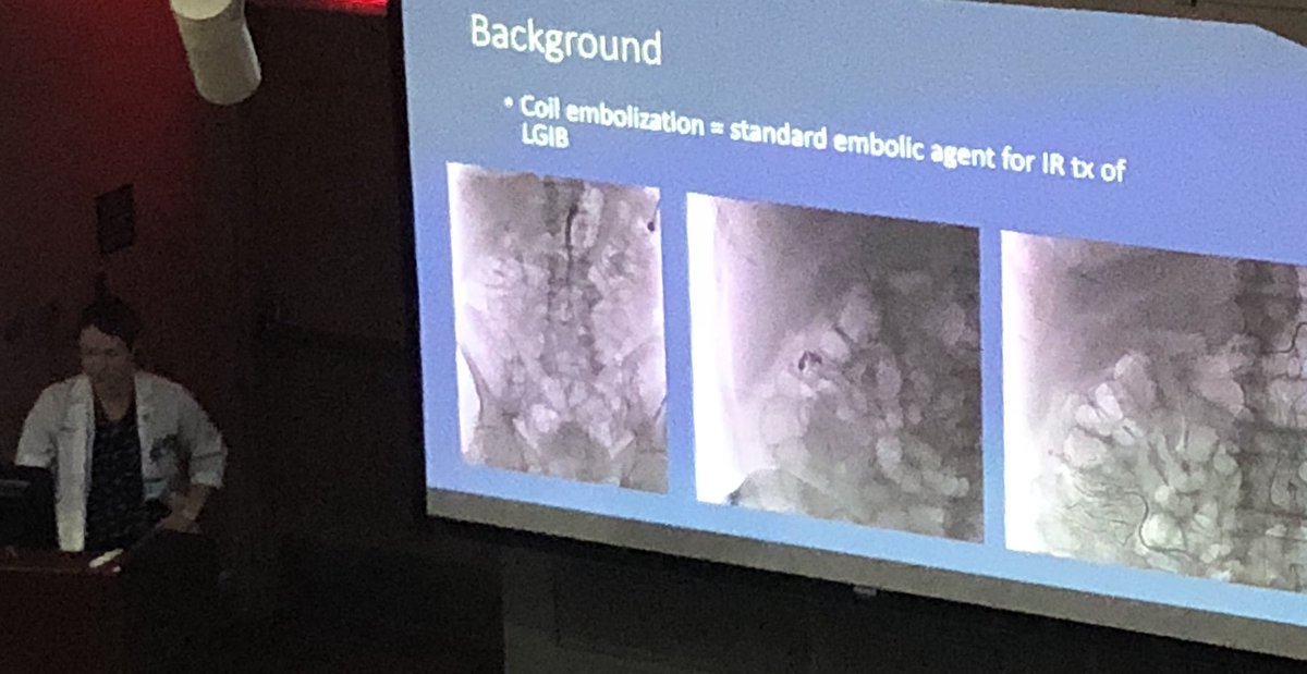 JonMartinMD's tweet photo. Live @DukeRadiology #DukeRadGR previews of #RSNA19 presentations. @DukeMedSchool star MS4 #EliseSeyferth presents on ischemic complications with particle vs coil embolization of #LGIB. See her presentation at @RSNA for details!! @charlesykimMD @DukeIR https://t.co/RA8Oq40Q9h