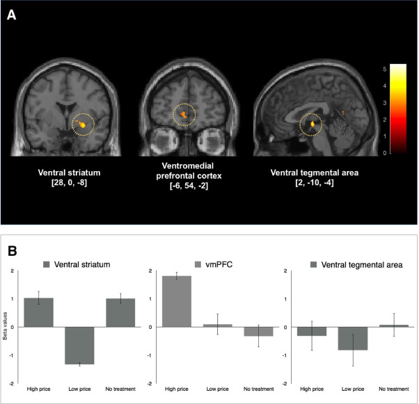 PhysioMeScience's tweet image. The context of values in pain control: understanding the price effect in placebo analgesia

💵💶💷

👀👀👇👇

sciencedirect.com/science/articl…