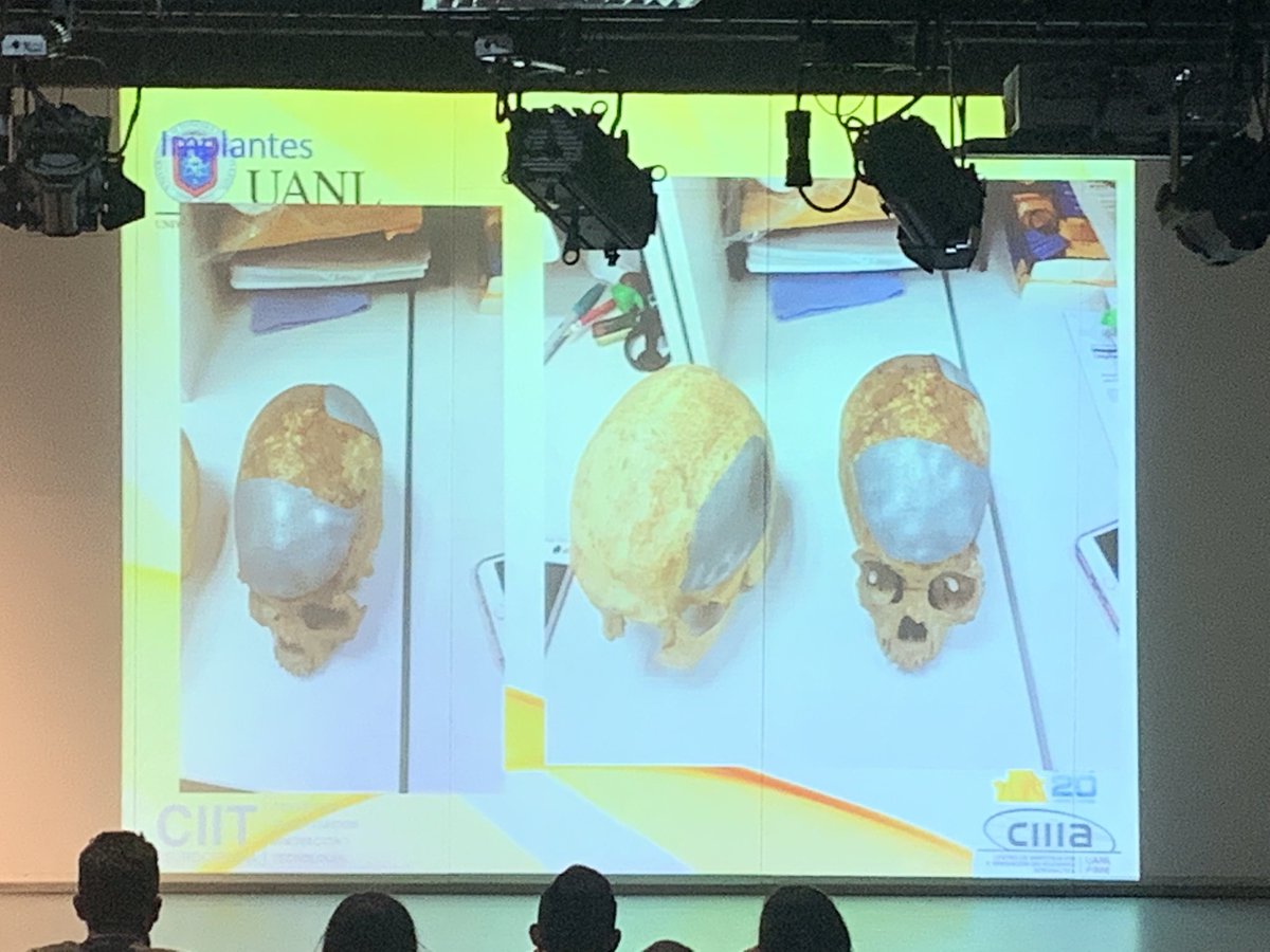 DGDCUNAM's tweet photo. Con la manufactura aditiva podemos desarrollar implantes para personas que han sufrido accidentes.
A nivel experimental ya se hacen implantes de cráneo 😮💀👍👏
#ImprimirElMundo https://t.co/JHwKEifWar