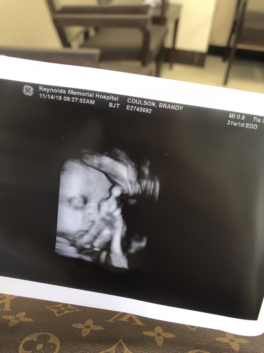 b__Coulson's tweet photo. 2 more months bub😘💙 https://t.co/yNd6OgJZ6i