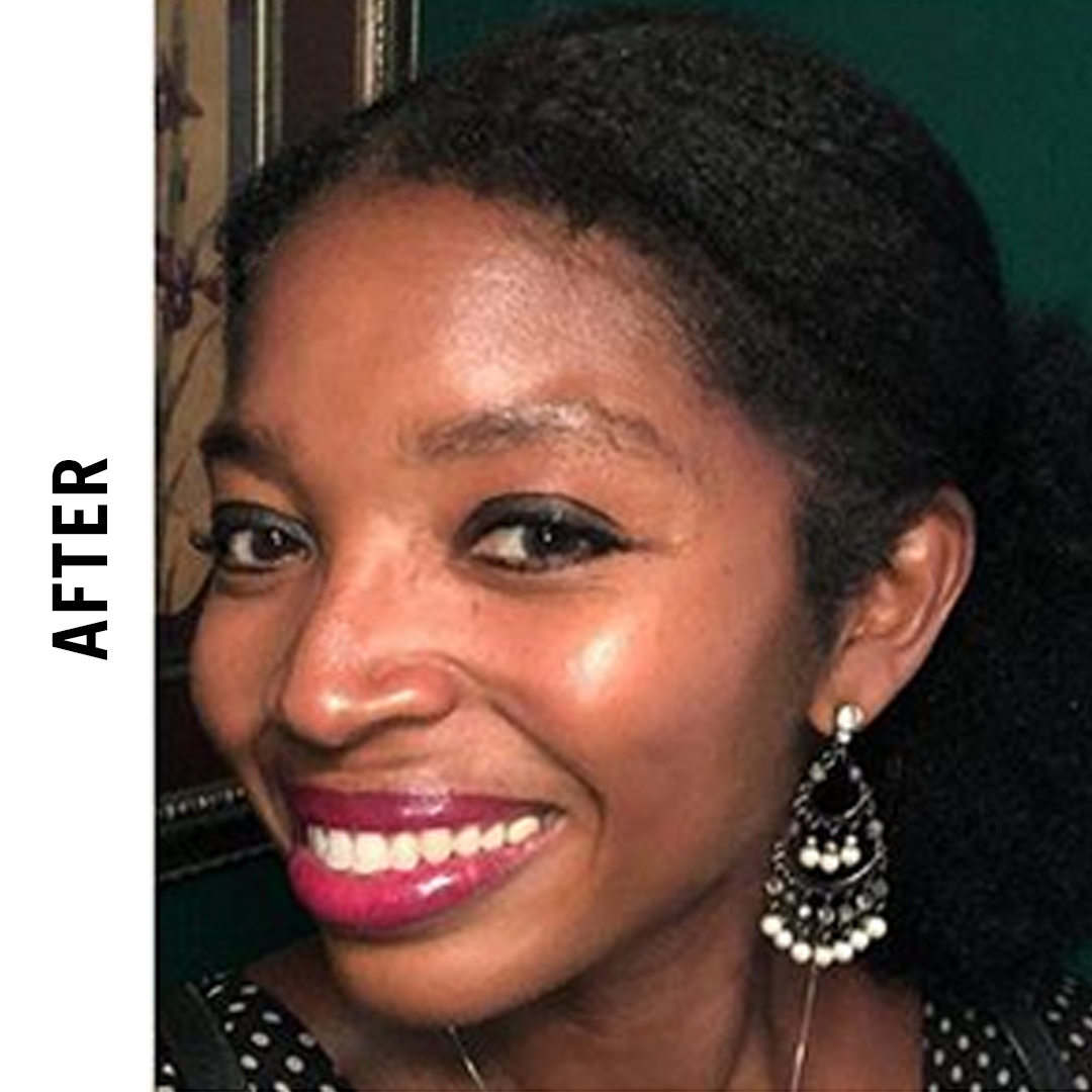 Not today! 🙅🏾‍♀️ <a href="/ElegantTripster/">That Golden Girl Life</a> was not having it with those sneaky grays showing up unexpectedly. #nomoregraysdays  
swipe 👉 left for the ‘after’. 
-
#grayaway #repost #instaglam #haircare #affordablebeauty #drugstorebeauty #beautycommunity