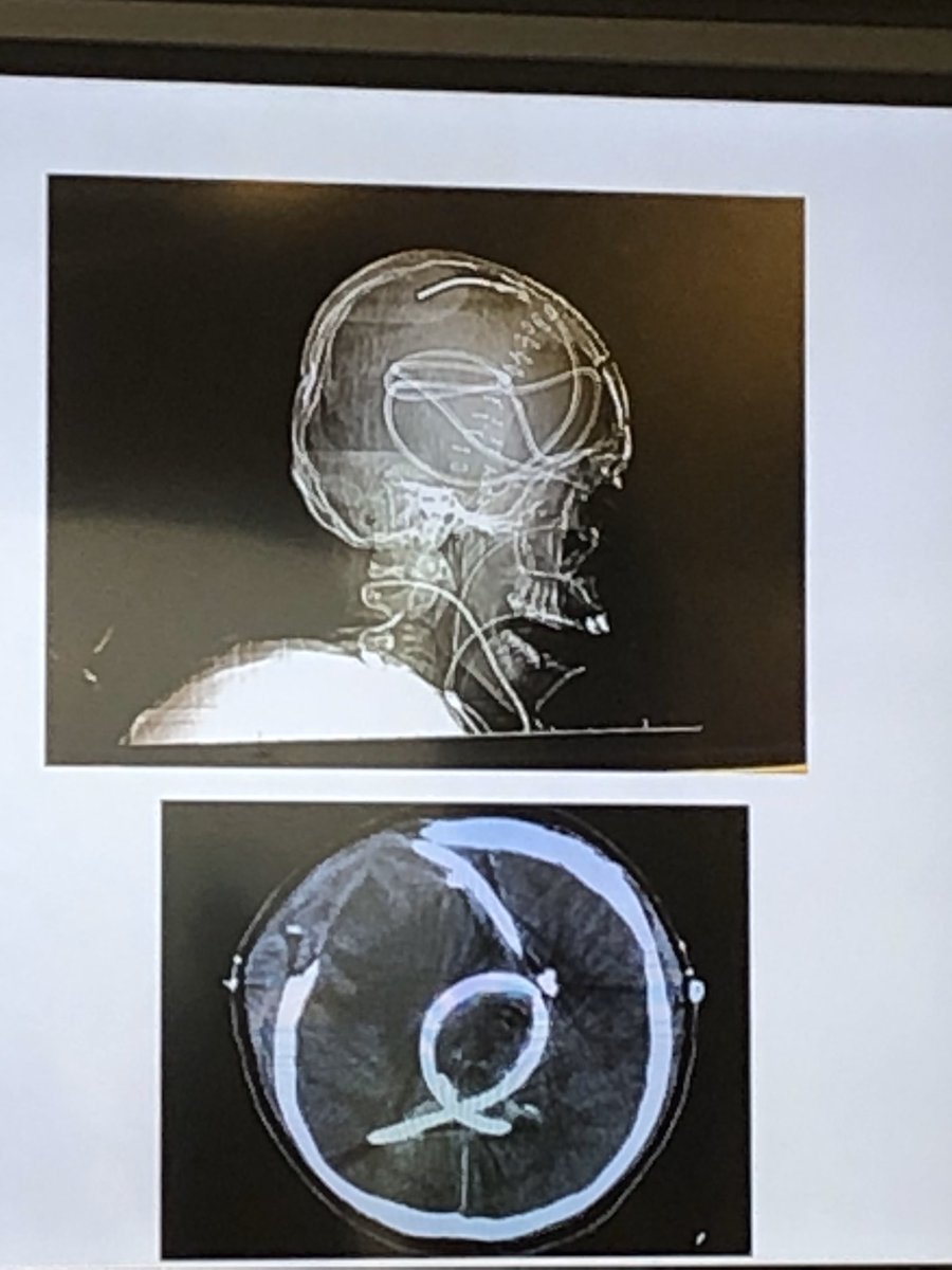 Jacob Lepard tweet media