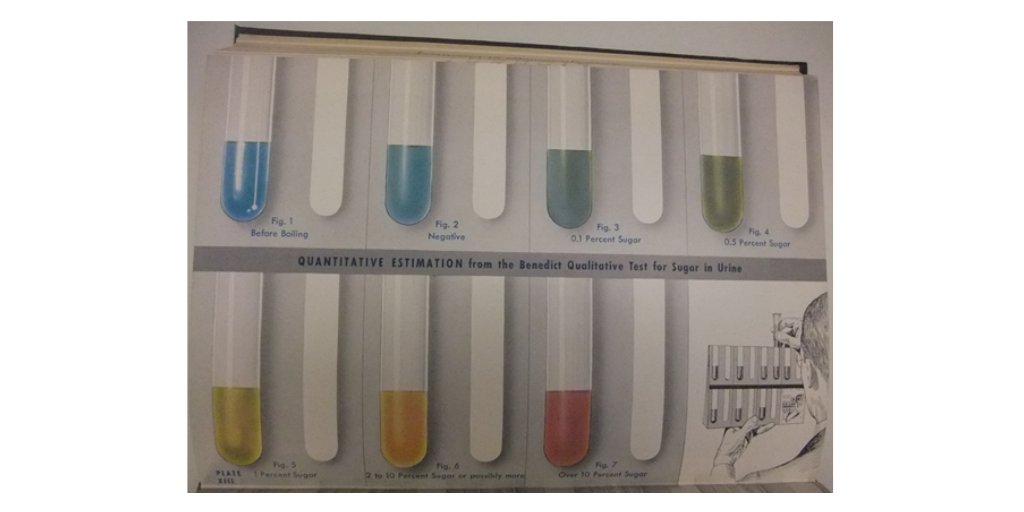 The user compared the colour in the test tube to a chart to get the percentage and know how much insulin was needed. This chart is from 1938. Almost all the colours of the rainbow.  #FellowFriday