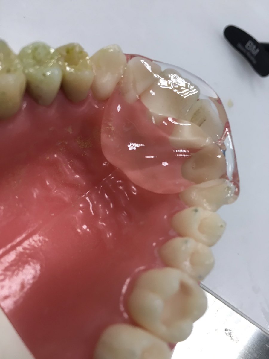 COECdentista's tweet photo. Probando la silicona transparente #Exaclear de @gciberica en el GC Europe Campus de @GCDentalProduct para realizar llaves para utilizar composite G-Aenial inyectable https://t.co/75D8wnNuSu