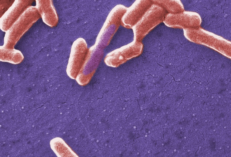 BMCBiology's tweet photo. From the archives: A widespread family of polymorphic #toxins encoded by temperate #phages
Authors propose MuF toxins influence the #lysogeny decision or serve as #bacterial weapons by inhibiting the growth of competing bacteria https://t.co/FIjIKmZKtV https://t.co/YMC0UHyHCy