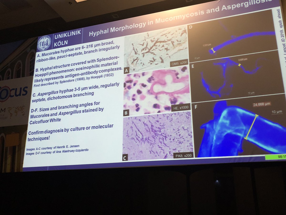 infectotuits's tweet photo. Un breve repaso de las nuevas guías de mucormycosis
‘Un mundo, una guía’
Noten la apertura en diagnóstico por imagen y la morfología de las hifas.
Además de las citas de los trabajos mas representantes en tratamiento
(Crédito @CornelyOliver )
#ISHAM #Infocus2019 https://t.co/SIAGfH6I7F