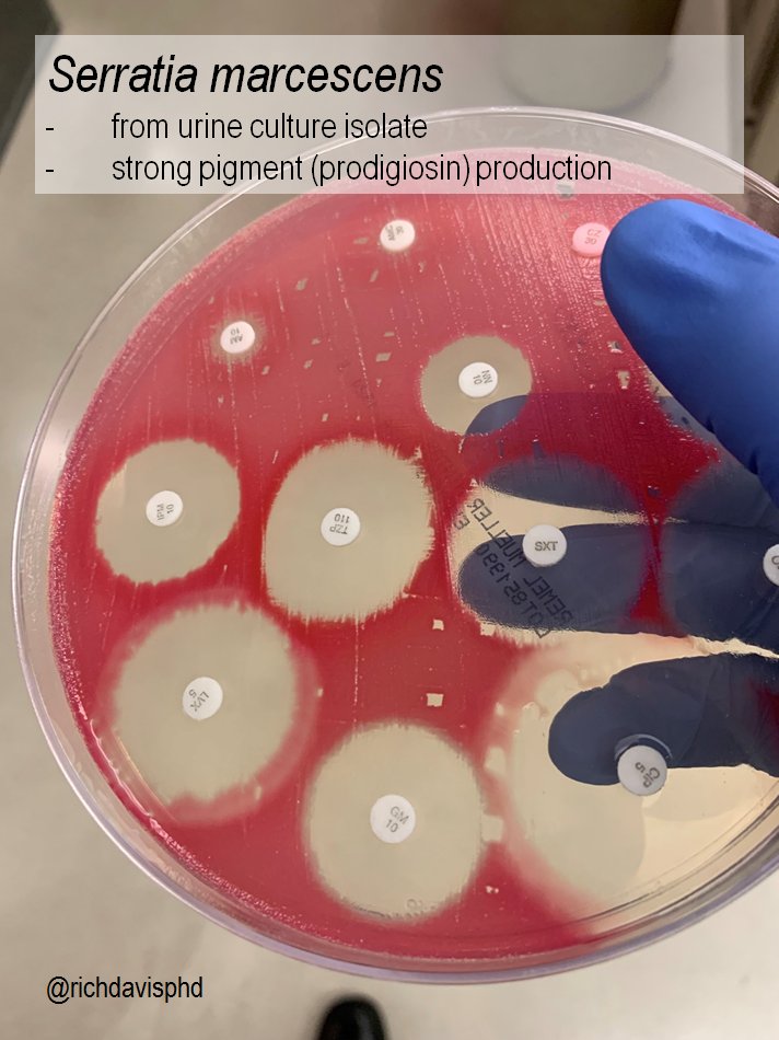 Rich Davis Phd D Abmm Mls On Twitter Microrounds Day 565 Pretty In Pink Different Sources Patients Same Pathogen 1 A Sputum Gram Stain Showing Clusters Of Pink Gnr Serratia Marcescens 2 Urine
