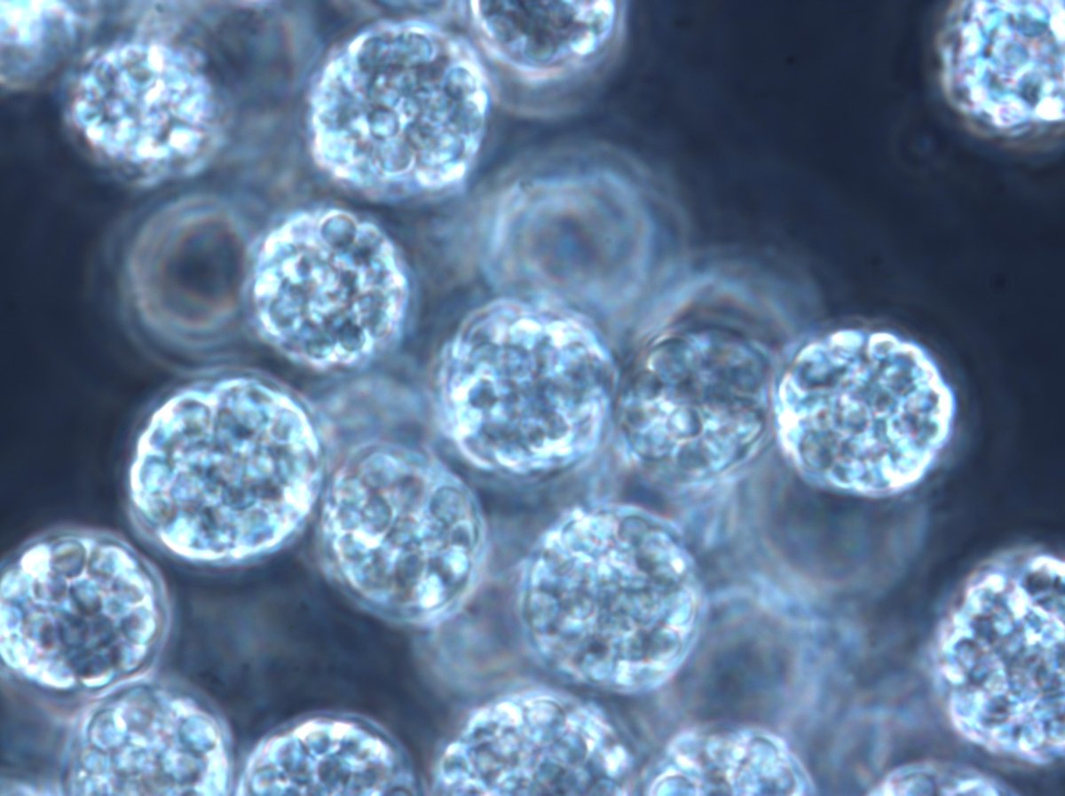 Worth a read! 
"Omega-3 fatty acids EPA and DHA from algae are now a viable alternative to fish oil", said Cristian Meinich, general manager of Norwegian fish oil trading firm Chr. Holtermann. undercurrentnews.com/2019/11/06/a-b…