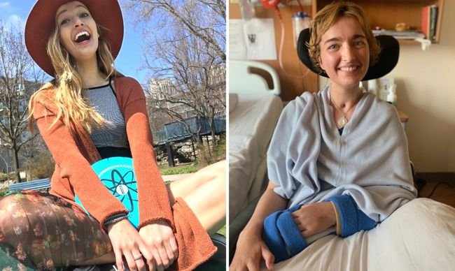 VisionZeroCA's tweet image. "Julia Cawse was run over by a man who drove into the #bikeTO lane on Dundas St E. In that instant, the promising future Julia had was permanently derailed. She survived, but suffered catastrophic injuries." 

DEMAND a #minimumGRID of PROTECTED lanes NOW.

thestar.com/amp/news/gta/2…