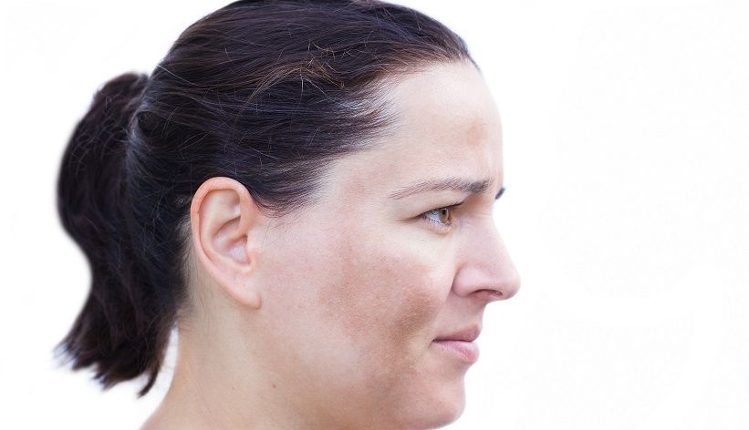 Dermatology Times tweet media