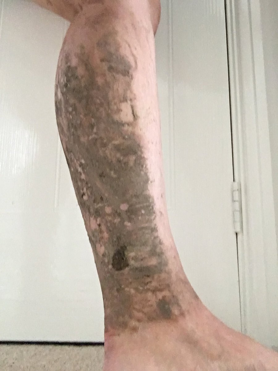 VeronicaBodell's tweet photo. Door, leg, mud.... @runup2christmas https://t.co/RXlIMQVxoF
