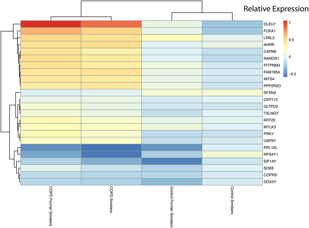 georgemias's tweet photo. Our new paper is out: Gene expression microarray public dataset reanalysis in chronic obstructive pulmonary disease Nice work by Dr. Rogers (@LavidaBrooks) and Maddie Verlinde  https://t.co/mN2NVUmYC7

@PLOSONE @MSUIQ @gmiaslab @msuresearch  #COPD  1/2 https://t.co/0aUPA7BVgM