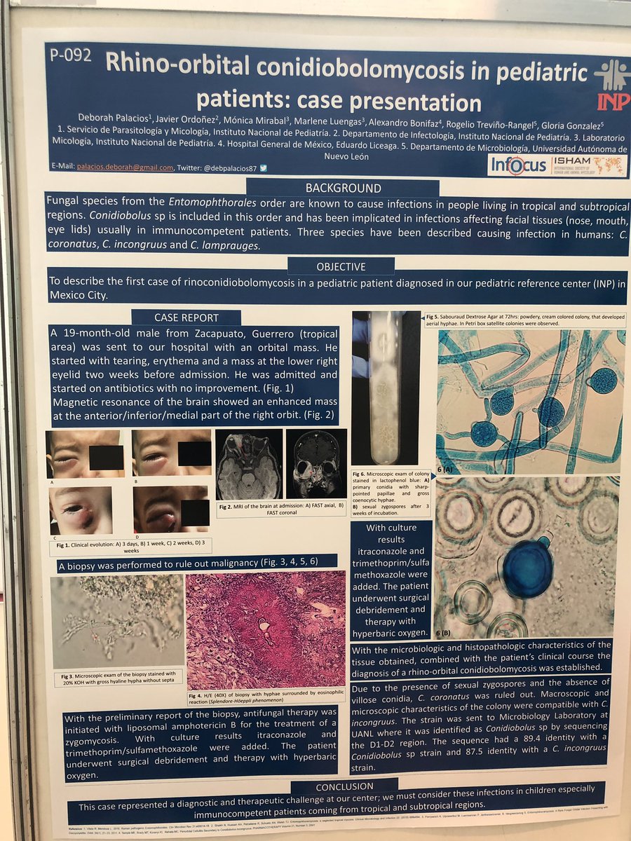 infectotuits's tweet photo. La Dra Palacios del INP con su trabajo de mucor en pediàtricos #MujeresCientíficas #OrgulloMexicano #Infocus2019 https://t.co/ByK9uoATY5