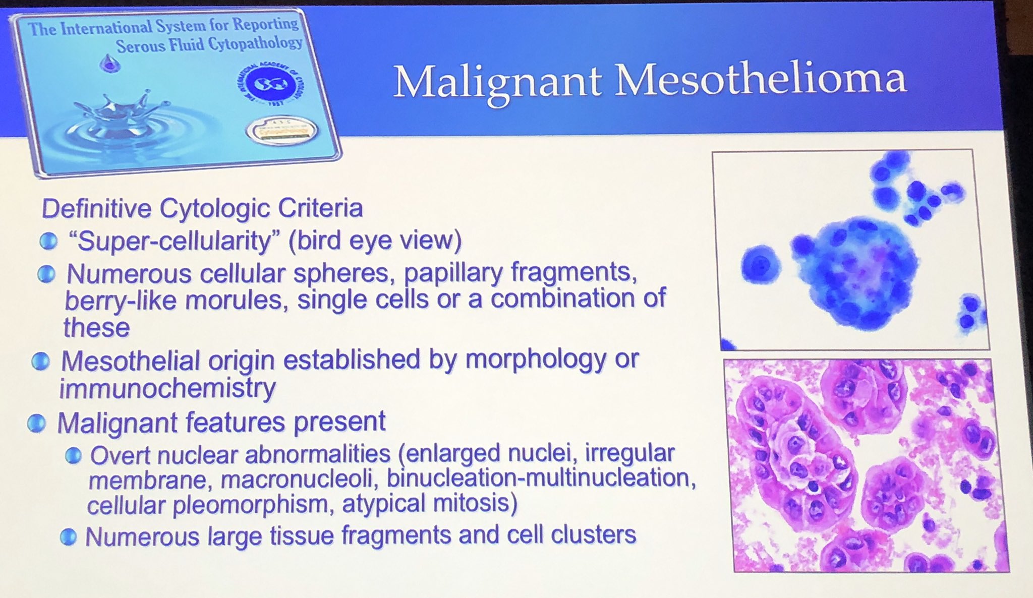 signs of dying mesothelioma