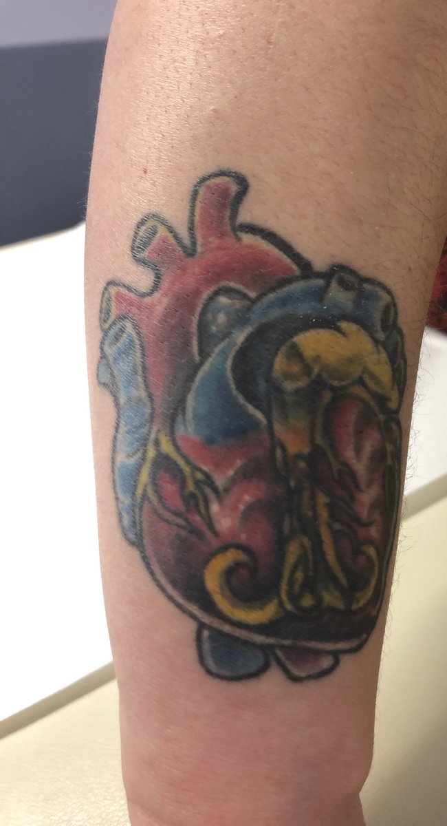 ebrosenzweig's tweet photo. Wearing your heart on your sleeve took on whole new meaning when I saw this today!!! #fightPH @PHAssociation @NYPCUCVI @PPHNet @AssociationWsph @asp156 @Kfarooqi @ushask01 @emilebachamd @ACHA_Heart https://t.co/2MEkHvtM0X