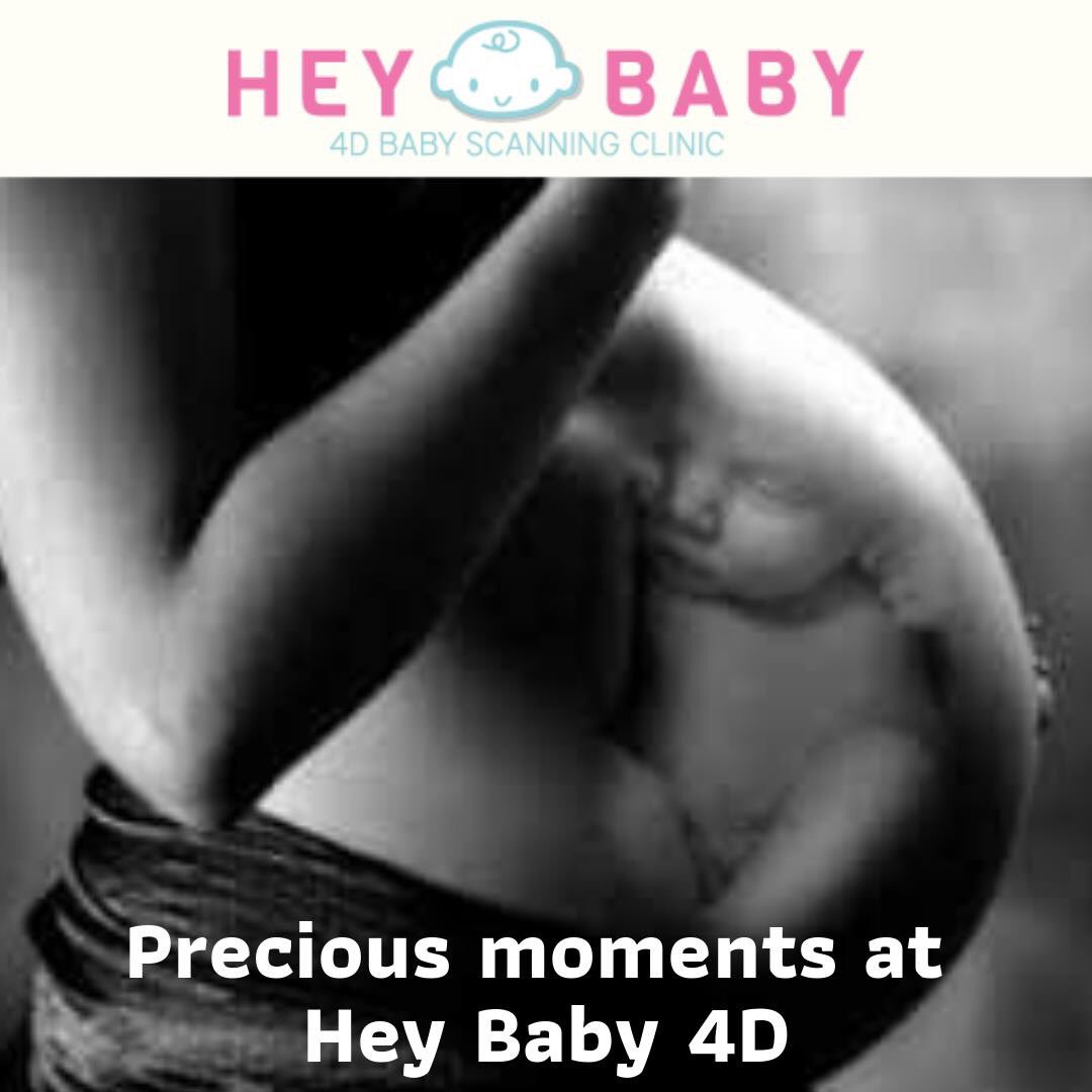HB4DStalybridge's tweet photo. https://t.co/N4HDsJy9dT
#stalybridge #tameside #glossop #Droylesden #Denton #Mossley #Highpeak #PeakDistrict #Stockport #4dbabyscan #saddleworth #Ashton #Hyde #4dultrasound #love #Baby #HeyBaby4D https://t.co/8fALAKbRP0