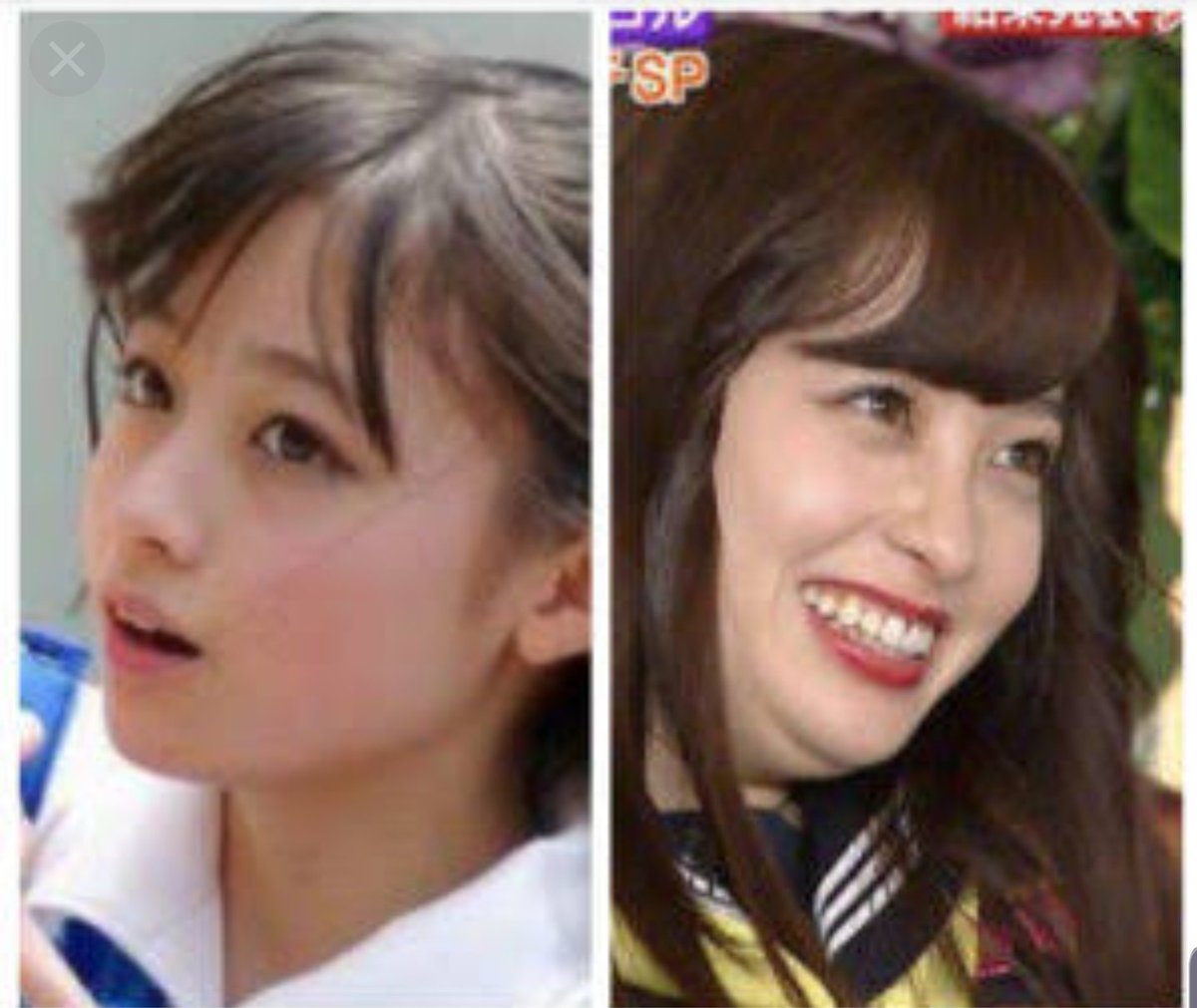 流星 マスターナンパ講師 En Twitter 顔に肉が多いタイプは整形より肉取り 肉がつくだけでかなり印象が変わる ちなみに肉取りについては相当課金してるから俺はかなり詳しい ちなみにちなみに肉取らなきゃいけない講習生にいくら言っても基本やらない 客観視 流星 マスターナンパ講師 En Twitter 顔に肉が多いタイプは整形より肉取り 肉がつくだけでかなり印象が変わる ちなみに肉取りについては相当課金してるから俺はかなり詳しい ちなみにちなみに肉取らなきゃいけない講習生にいくら言っても基本やらない 客観視