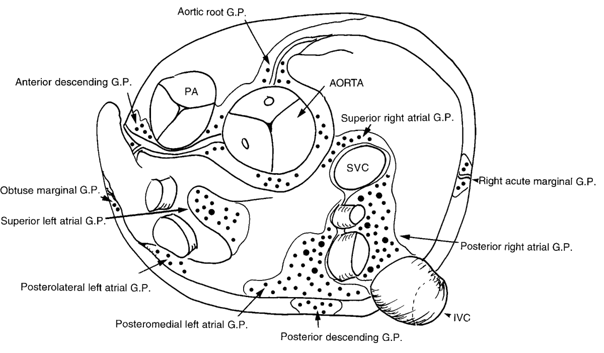 glumia's tweet photo. @PietroRossiEP @stefbianchi @FilippoCauti @MDTolgaAksu @luigiaia Interesting question @PietroRossiEP. Is the PR reduction greater with right or left encircling? I remember this paper, about Cardiac Ganglionated Plexuses (Armour J.A. The Anatomical record 1997), that you sent me many years ago. https://t.co/wH9GYglSKm