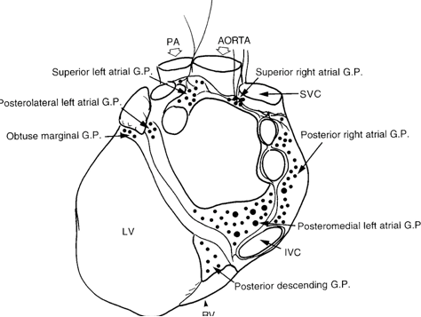 glumia's tweet photo. @PietroRossiEP @stefbianchi @FilippoCauti @MDTolgaAksu @luigiaia Interesting question @PietroRossiEP. Is the PR reduction greater with right or left encircling? I remember this paper, about Cardiac Ganglionated Plexuses (Armour J.A. The Anatomical record 1997), that you sent me many years ago. https://t.co/wH9GYglSKm