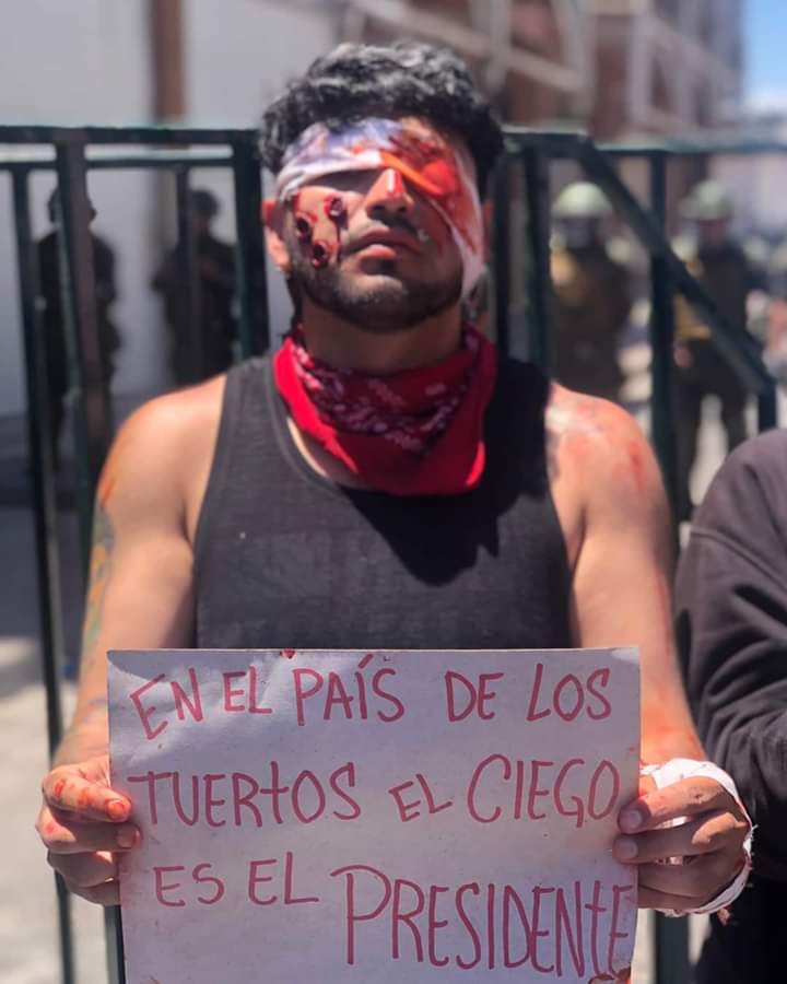 Grone69's tweet photo. Nunca hubo paz
Nunca nos escucharon
Nunca nos respetaron

Y el responsable no da la cara.

#AcusacionParaPiñeraYa
#EstoNoHaTermimado https://t.co/Szjw4upIwf