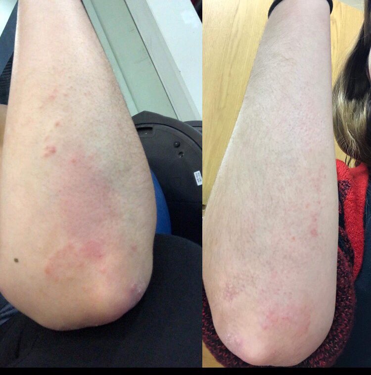 SpringfieldHW's tweet image. Before and after photo after just 1 week of following our nutritional advice.
If you are considering better health, visit our website #holistichealth springfieldholisticwellness.com