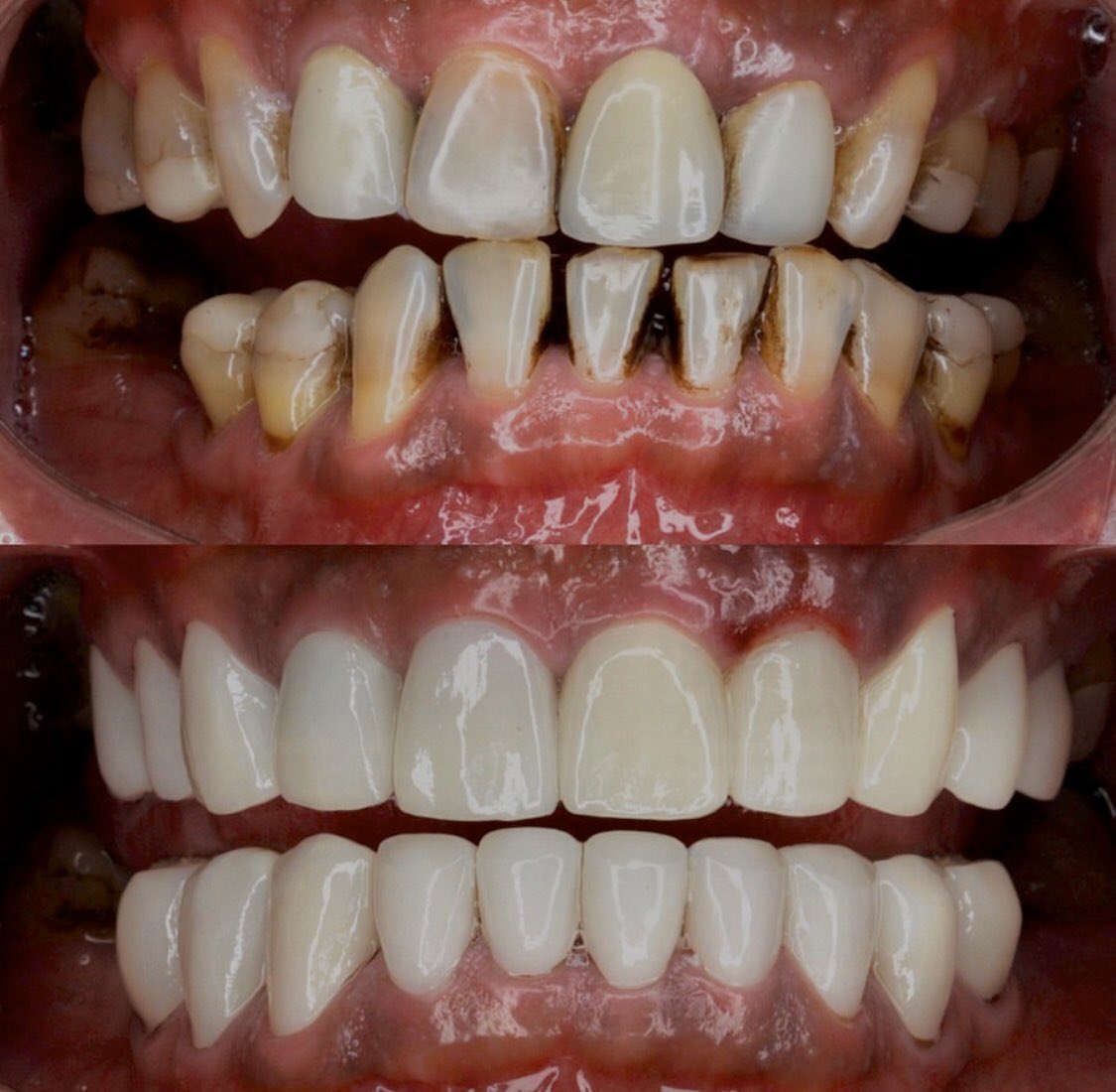 Манай эмнэлэг Шангри-Ла молл 2давхарт Premier Esthetics Dental Studio гээд эмнэлэг бий. Та бүхэн 77070722 80100722 дугаарт цаг аваад үзүүлээрэй. баярлалаа