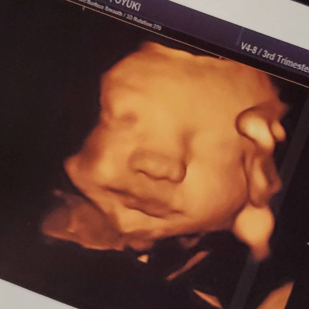 _yukiii__'s tweet photo. I truly can't wait to meet you 💕 #daddysmini https://t.co/FMHIGClHje