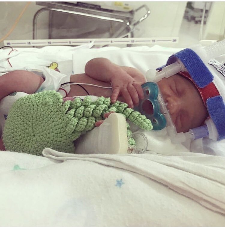 lesleymcconnon's tweet photo. Today is #WorldPrematurityDay ❤️ My beautiful little niece was born on 16.04.19, 8 weeks early weighing just 1.595kg. Now she 6 months old and an absolute wee ray of sunshine. #evygrace #premmiebaby #weefighter https://t.co/kNOYfMldZa