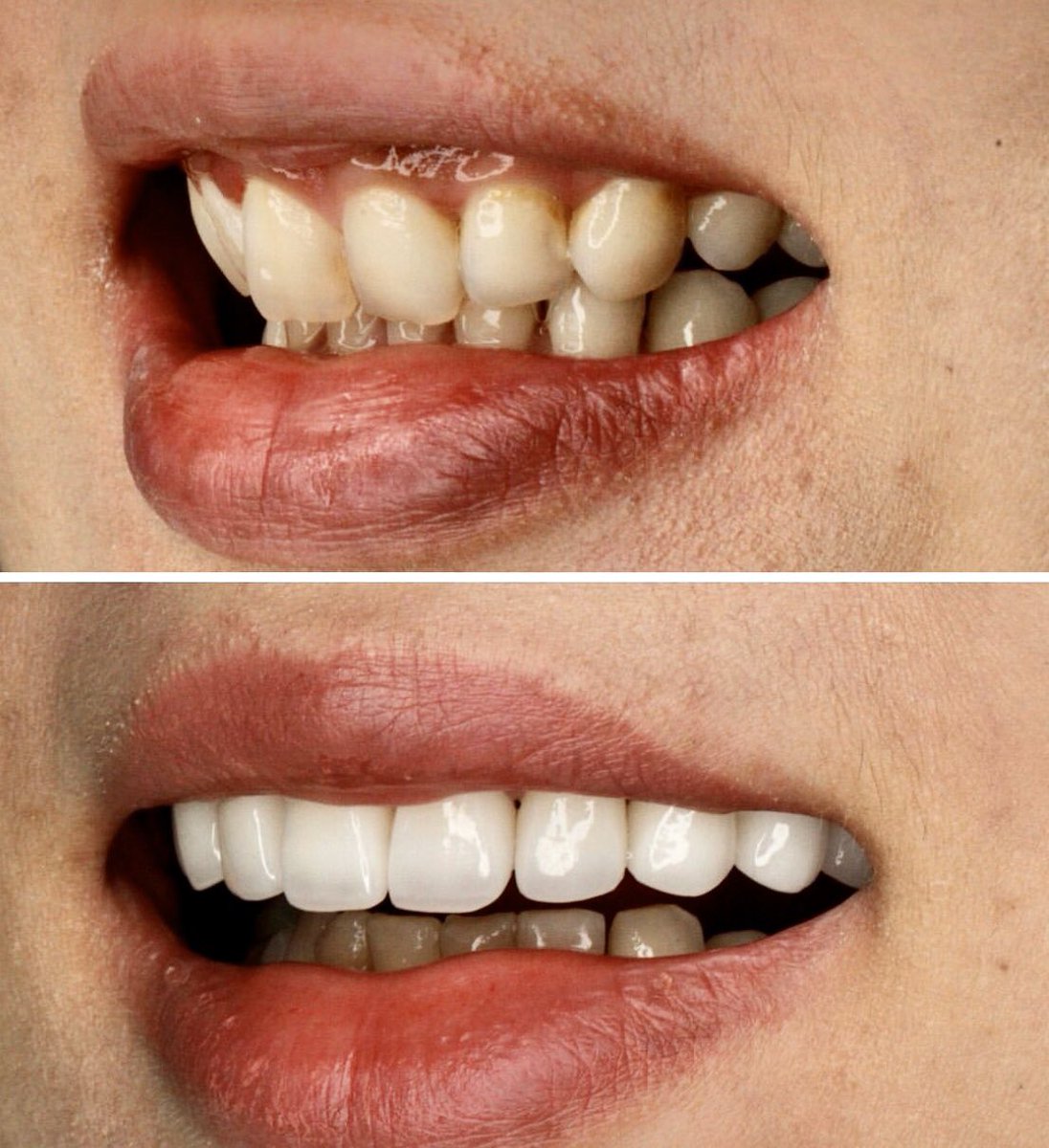 instagram.com/p/By-DWwkBLfP/…