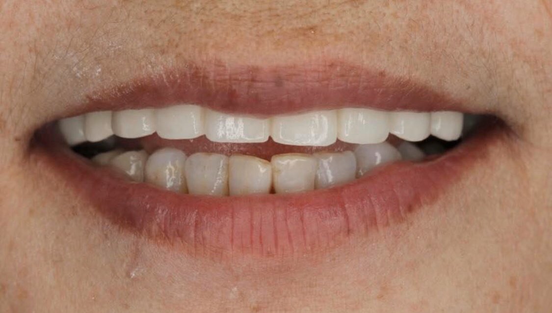 facebook.com/78378337838948… твиттерт 4н л зураг оруулах боломжтой байдаг юм байна тэ 😅 .Зөндөө л хийсэн ажлуудаа үзүүлмээр байдаг. /Линкрүү ороод үзээрэй баярлалаа.