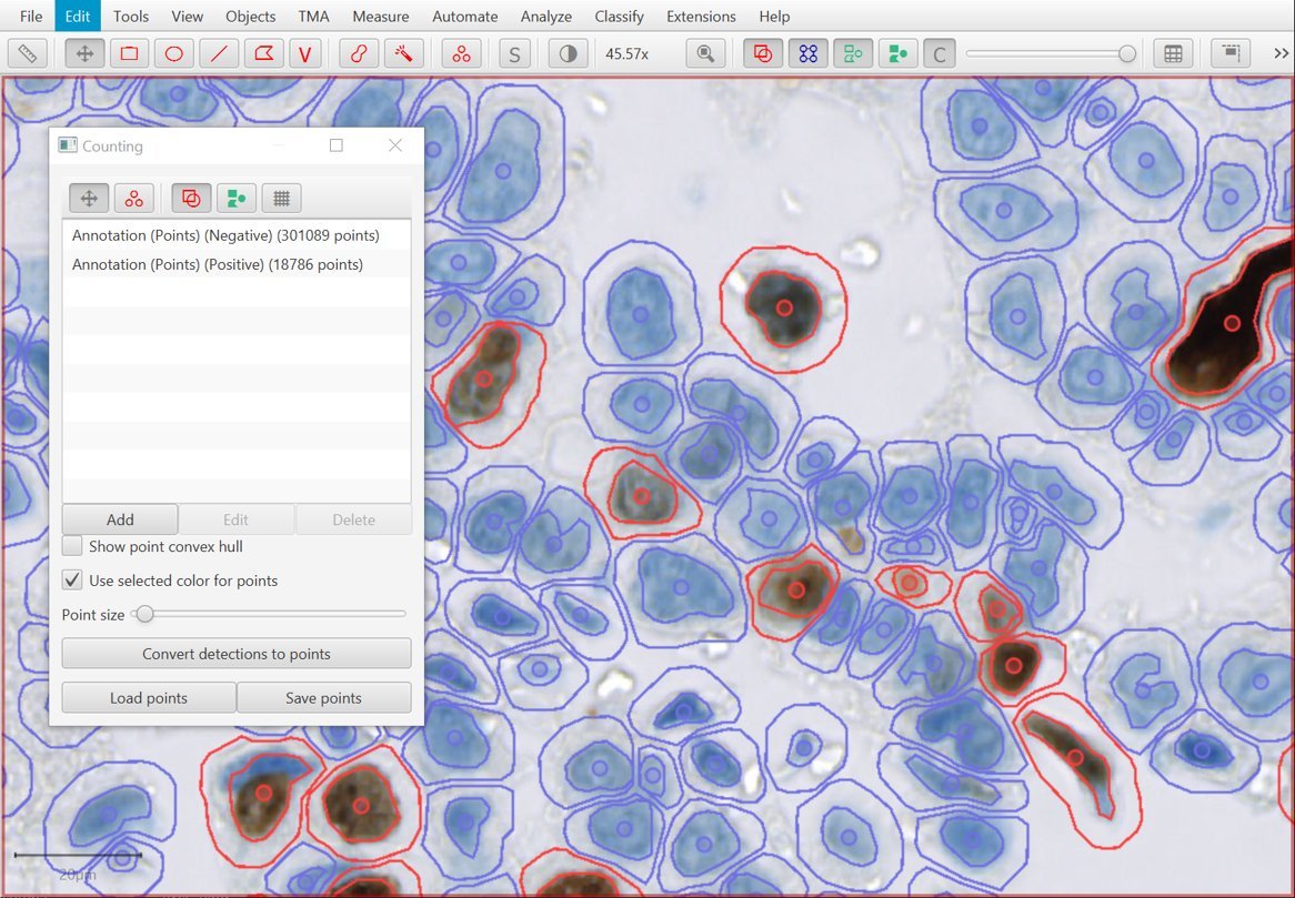 Pete Bankhead At Petebankhead Twitter