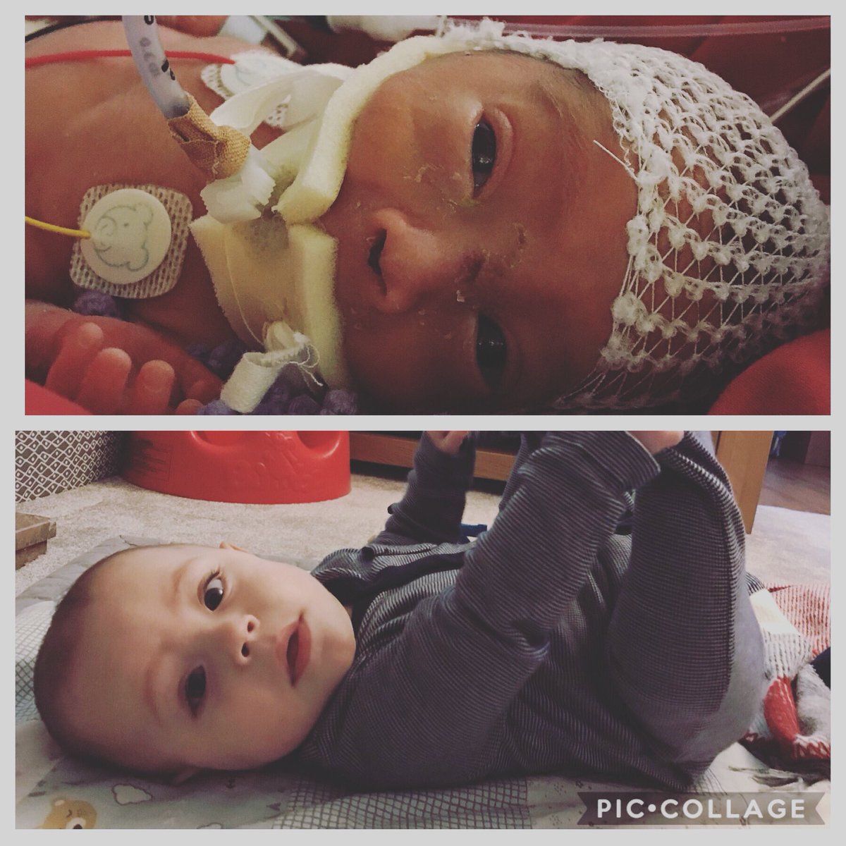 nick_rance88's tweet photo. 130 days in @UHSFT, 130 days at home! On #WorldPrematurityDay weโre so greatful for the care and support we received at Princes Anne Hospital this year! Our little warrior is now flourishing! #neonatal #princessannehospital #premiebaby #25weeker https://t.co/BIlE4zE7P0