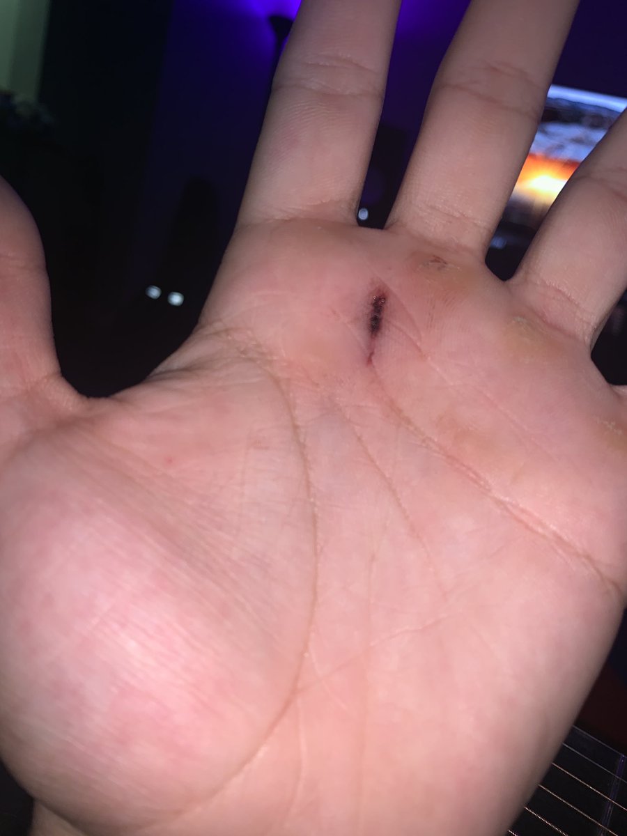 i jus stabbed myself trying to cut an avocado.. not my best moment haha