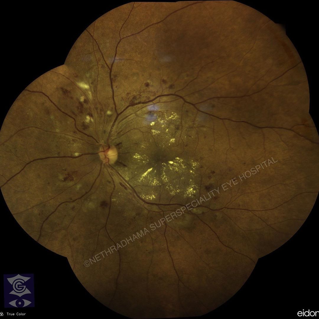 CENTERVUE tweet media