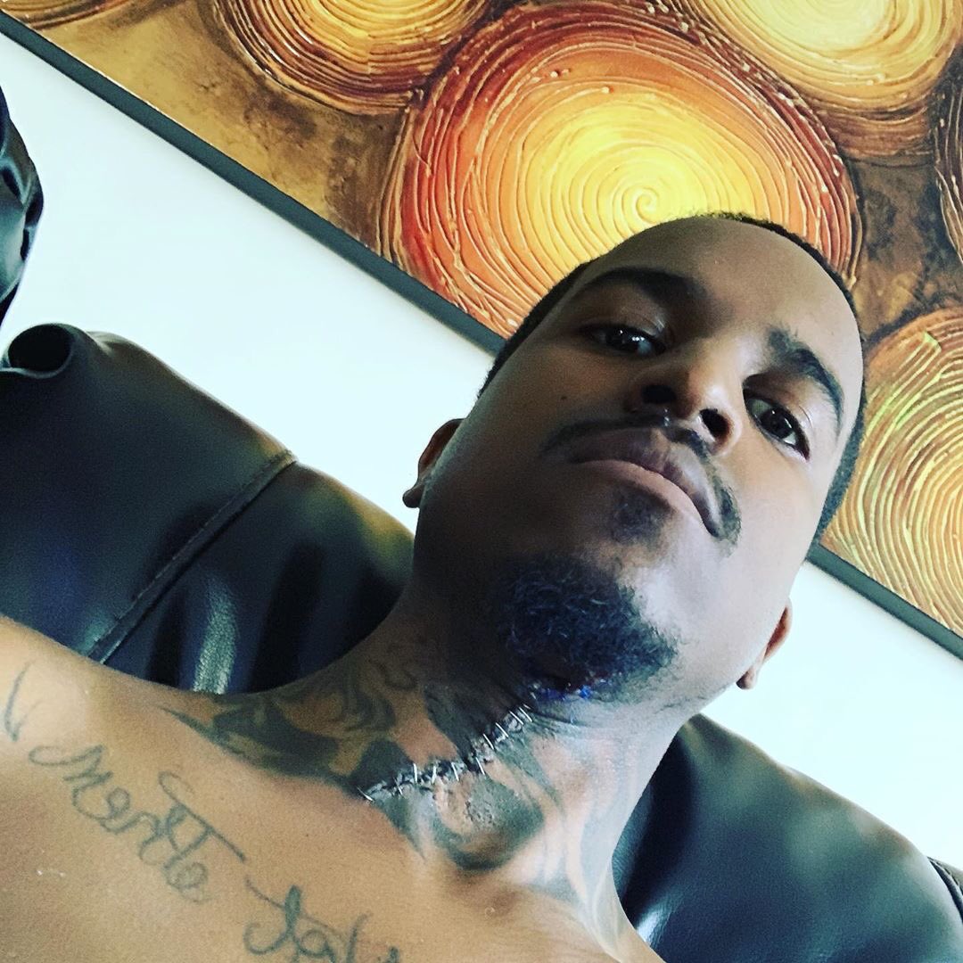 getintunemedia's tweet photo. Lil reese after the shooting #LilReese #chicago #hiphop #music https://t.co/xBHA3PXH84