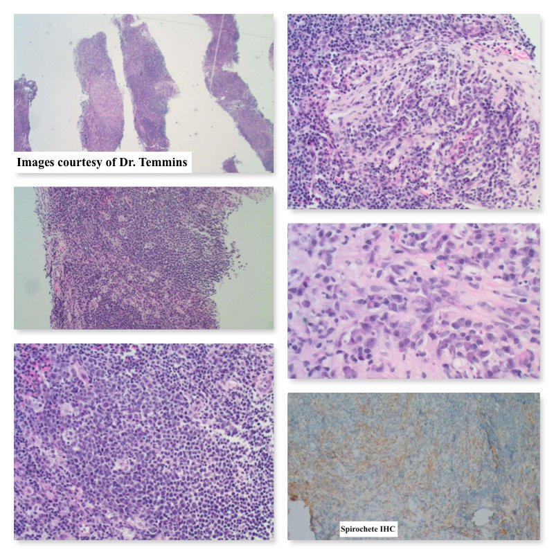 South Bay Pathology tweet media
