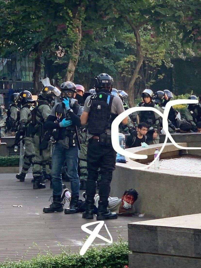 VerbatimHKG's tweet photo. Three arrests at #PolyU while one man with mask is clearly bleeding profusely on the ground.
"Minimum force" used huh, #HongKongPolice ?
#StandwithHK #StandWithPolyU #HongKong #hongkongpolicebrutality https://t.co/VhraAv6wwN