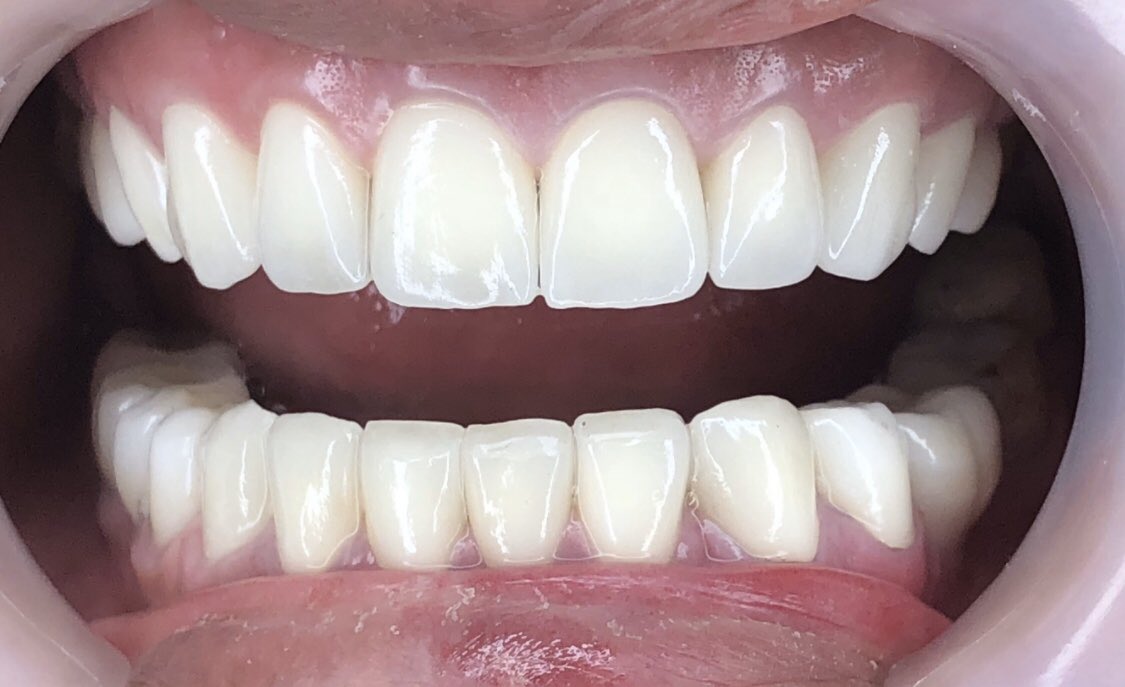 Шүдний эмчилгээ бол нарийн төлөвлөгөө юм. 
Шүдний эмчилгээ бол нарийн мэдрэмж билээ.