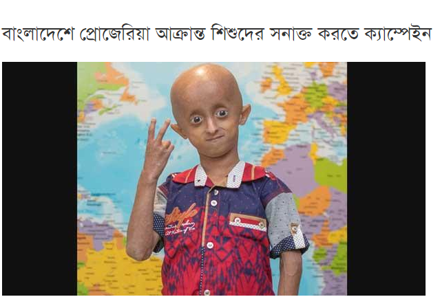 TeamNihal's tweet photo. Announcing the launch of ‘Find the Children – 10 in Bangladesh with Progeria’ campaign to ignite the search for children with Progeria in Bangladesh. #Finding10inBangladesh #Progeria #RareDisease #Bangladesh #News 

https://t.co/3fzg29nQmk

@Progeria @GLOBALHealthPR @MMCommn https://t.co/mVv4lLjCkU