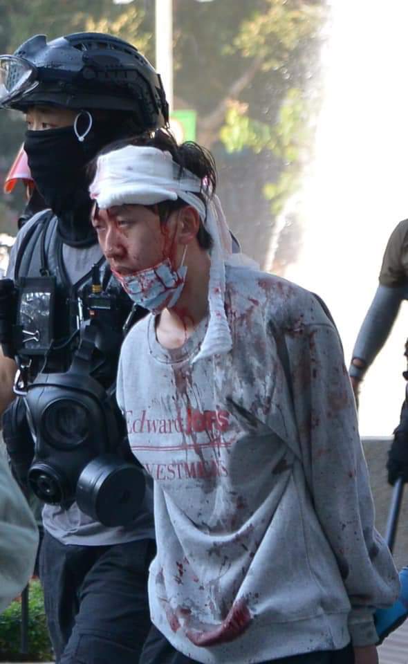 sillycrazycandy's tweet image. From fb 
1118紅磡
//犯法可以拉，可以告，可以判處入監獄，但警方亦不能打到人頭破血流。這就是香港市民，為何叫他們做黑警的原因！

這張相真的有點像六四的感覺

#8964
#八九六四
#soshongkong