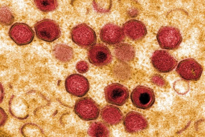 African swine fever reaches the German border. The virus was detected in wild boar in the Lubuskie Volvodship province in Poland. Maximum vigilance indicated for people in the region, especially related to hunting and foods of swine origin.