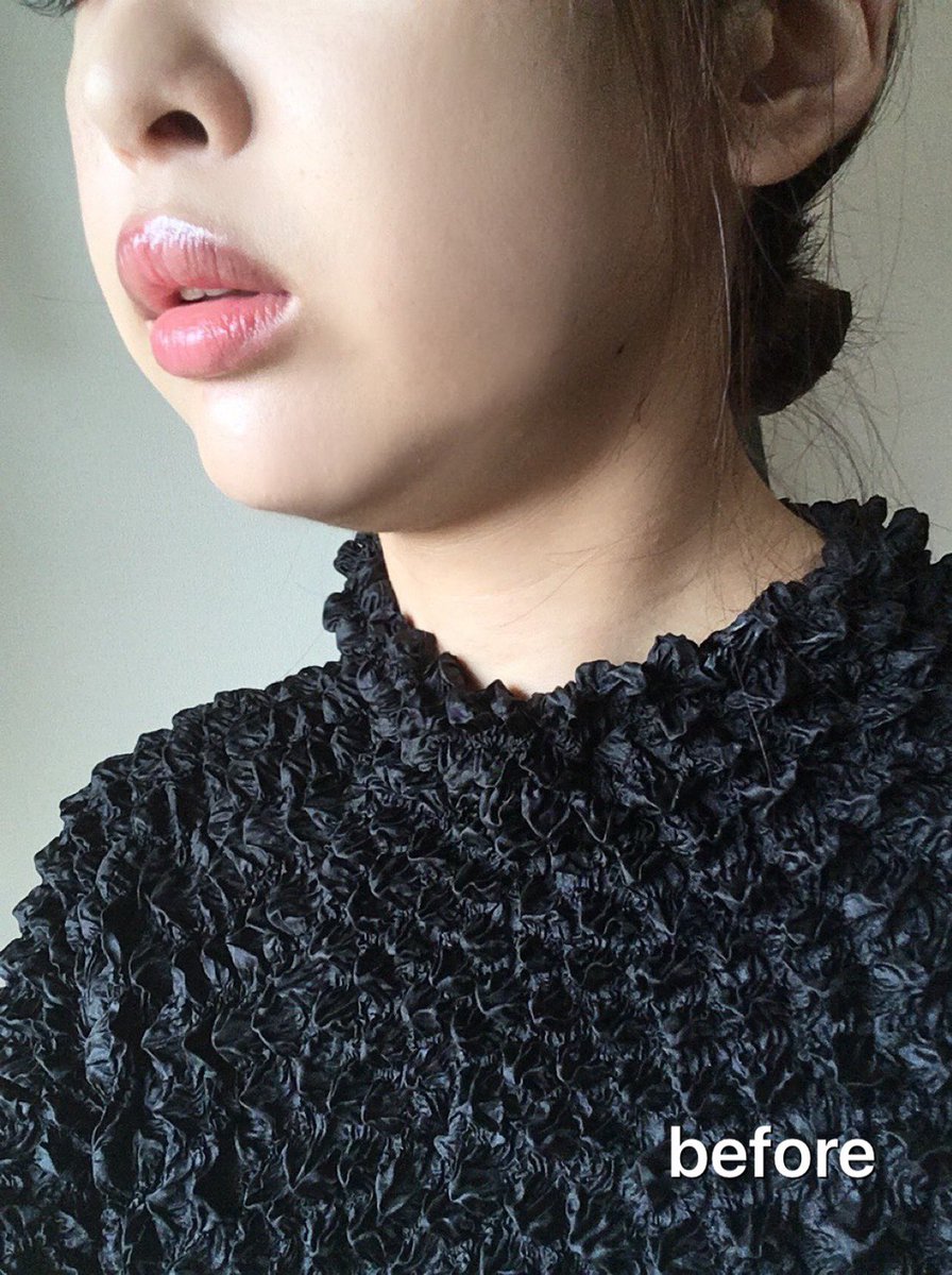 mmtr421's tweet photo. コスパも効果も神😭💕
ビフォーアフター変わりすぎて焦る😂
そんなに顔パンパンだったかな？🤣
KGOフェイスクリーム最強🙌
普段写真入れないけどヤバすぎて載せる、、笑
#スマホあご #小顔 #二重顎 #kgoフェイスクリーム https://t.co/9JkSv1qb9N