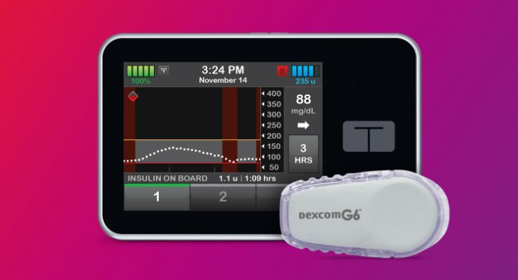 parthaskar's tweet image. Fantastic to catch with @ALDiabetesUK and hear about their pipeline especially #ControlIQ @dexcom 

We @NHSDiabetesProg @NHSGIRFT working to ensure option of t:slim #Tandem available across all areas- fingers crossed #T1D #Technology