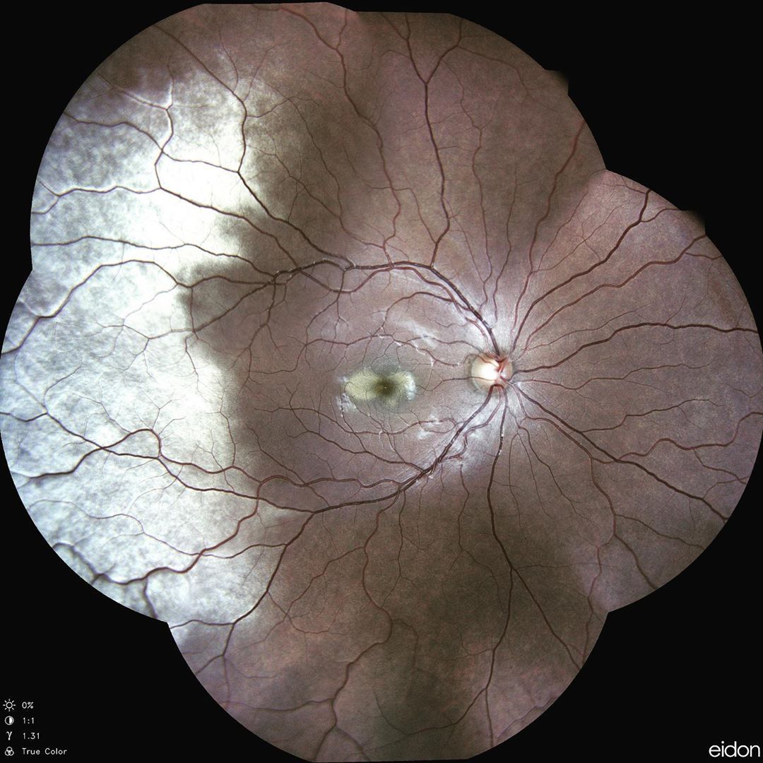 CENTERVUE tweet media