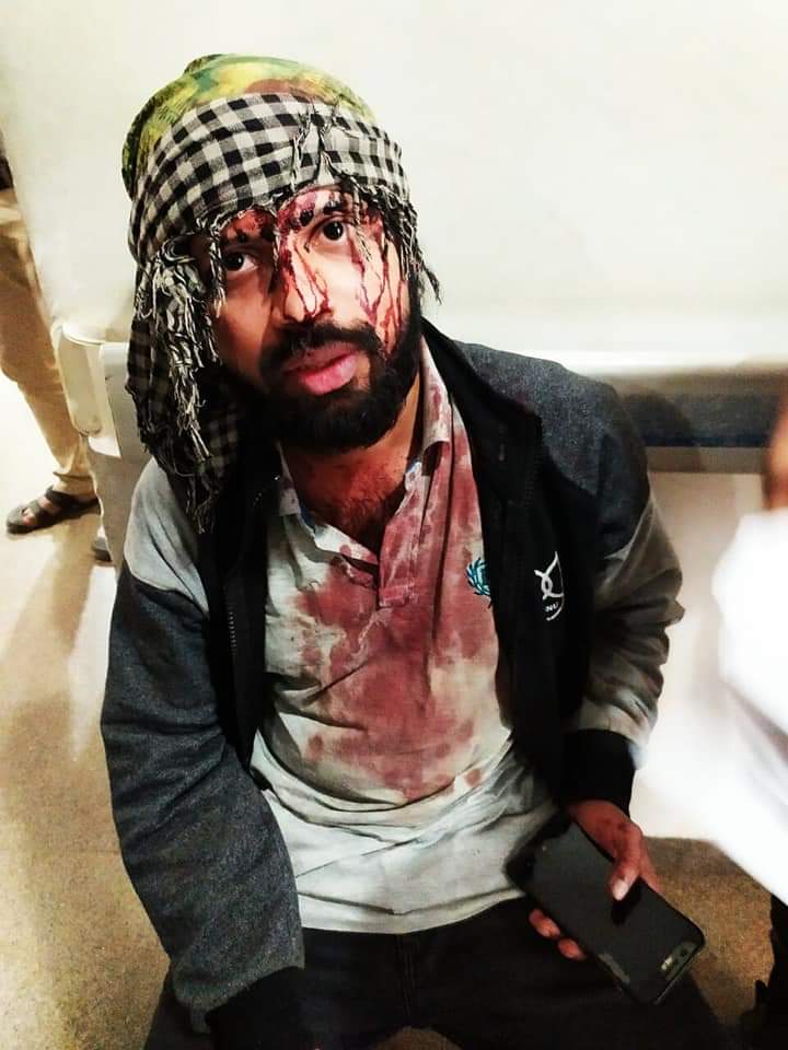 UmarKhalidJNU's tweet photo. JNU students are a beacon of hope. Taking blows on their bodies, they march forward for a better future for all, for everyone's right to education. Shame on you JNU VC, for bringing this situation where students are being brutalized for demanding their basic right #EmergencyinJNU https://t.co/6JxZlx7ien